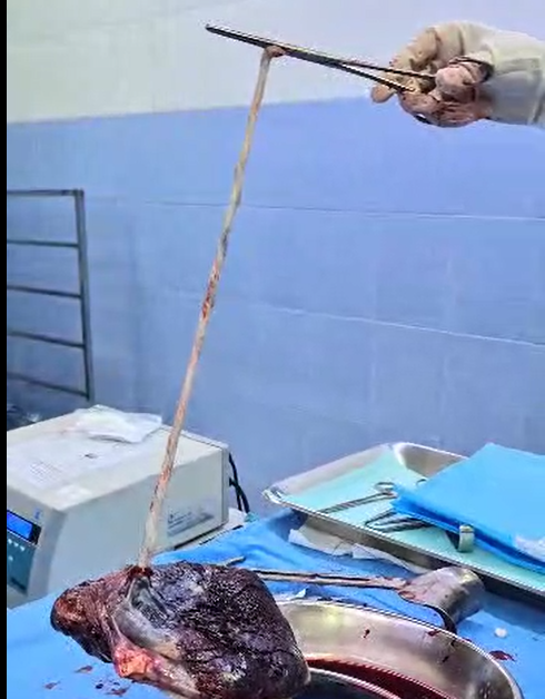 جفت بارداری