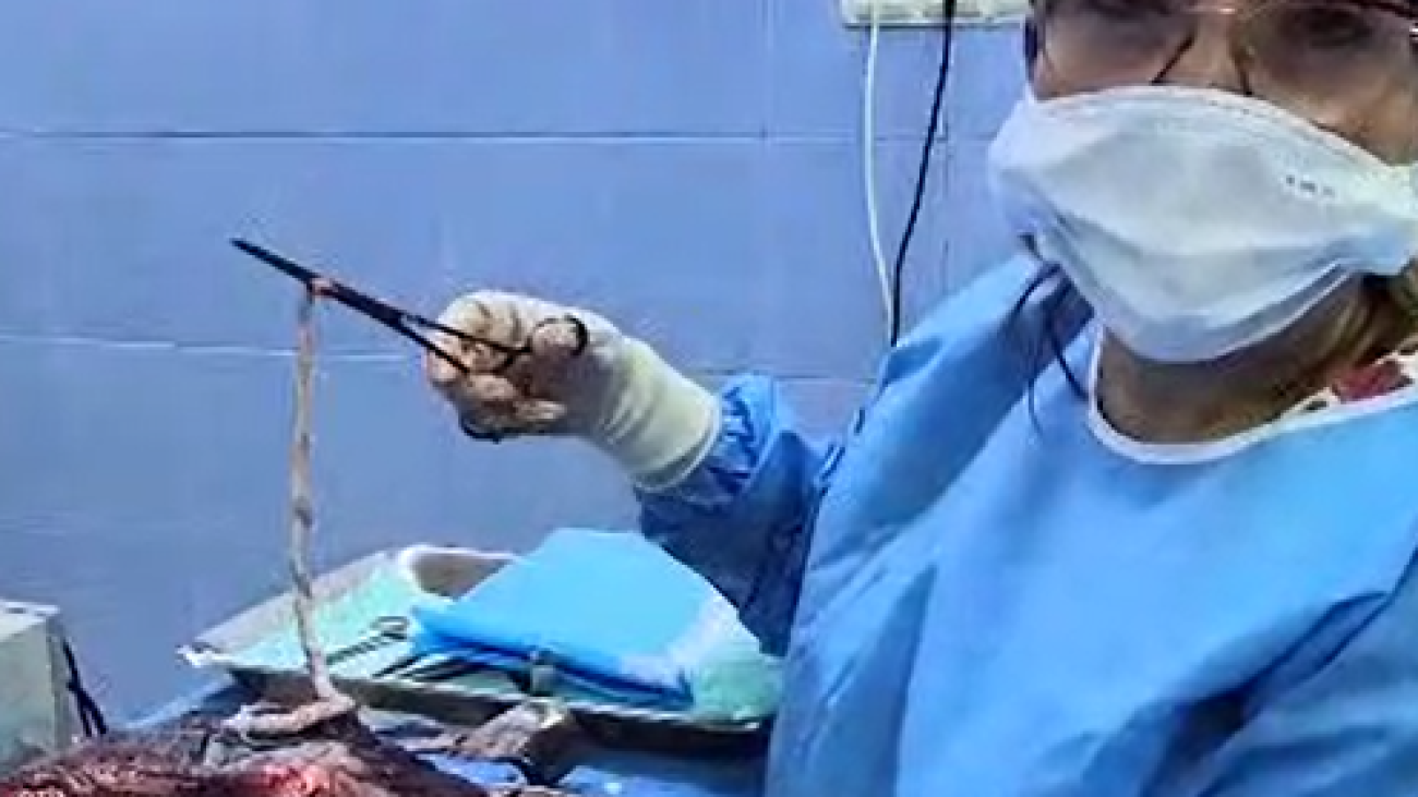 جفت بارداری چیست