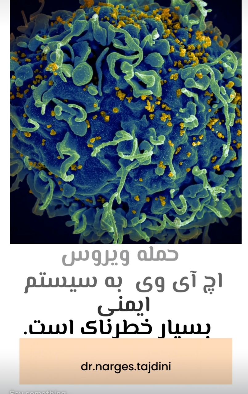 حمله ویروس اچ آی وی به سیستم ایمنی بسیار خطرناک است